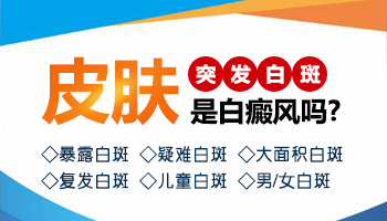 不知道是不是白癜风做哪些检查确诊