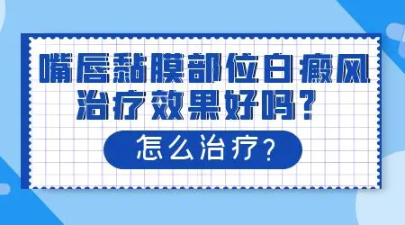 嘴唇上长白斑怎么治疗效果好