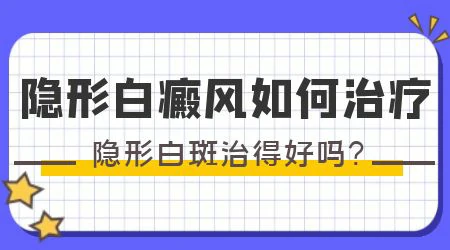 隐形白癜风能照光吗