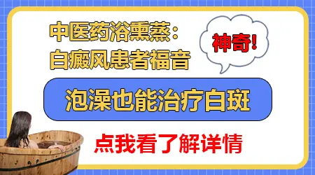 皮肤白斑可以药浴治疗吗