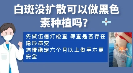 白癜风七八年没扩散有必要治疗吗