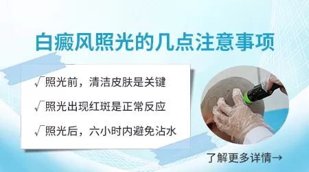 308激光治疗白斑多久见效