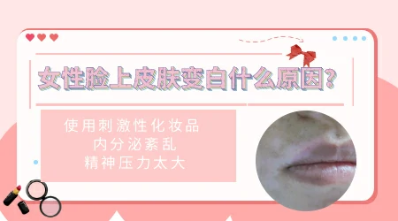 女性皮肤白斑是什么原因引起的