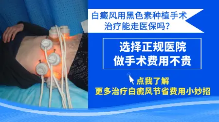 石家庄哪个医院看白癜风好