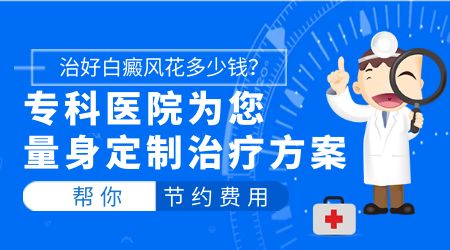 白癜风治疗费用大概是多少钱