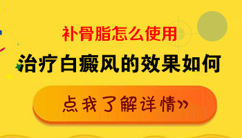 类似补骨脂治疗白癜风的偏方效果怎么样