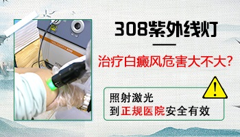 308光和308准分子激光哪个治白癜风好