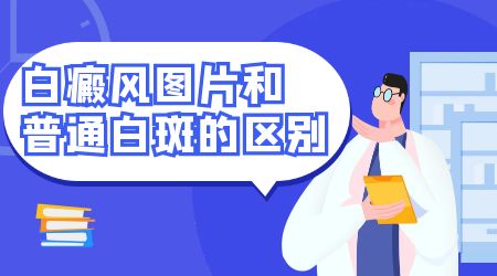 白癜风图片和汗斑图片详细对比