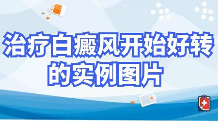 白癜风家用308治疗仪哪一款好