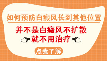 手指上的白癜风会长到脸上吗