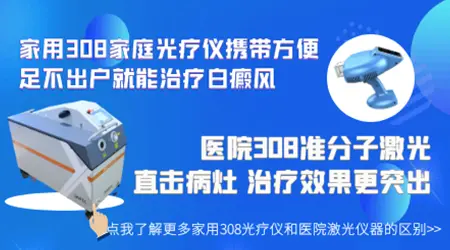 能不能用家庭308激光治疗仪治白癜风