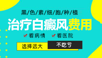 白癜风种植一个点那么大的面积是多少钱