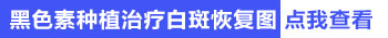 白斑有黑色素往中间靠还要继续治疗吗