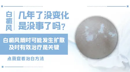 一个白点三年没长是白癜风吗