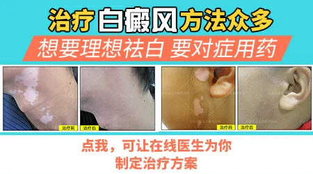 孩子手上腿上白斑是什么