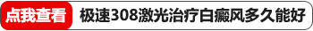 孩子的白癜风照308激光多久一次比较好