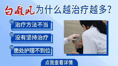 为什么治疗白斑病情反而加重了