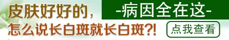 屁股沟为什么会长白癜风