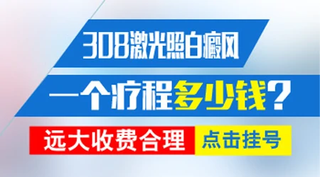 308激光治疗白癜风按面积收费吗