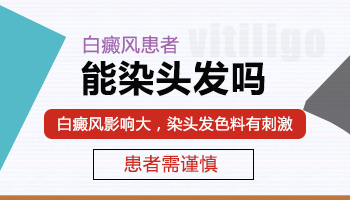 男士头上白斑可以药物治疗了吗