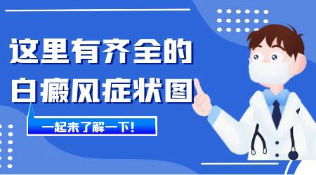 近几日白癜风周围颜色变浅是病情加重了吗